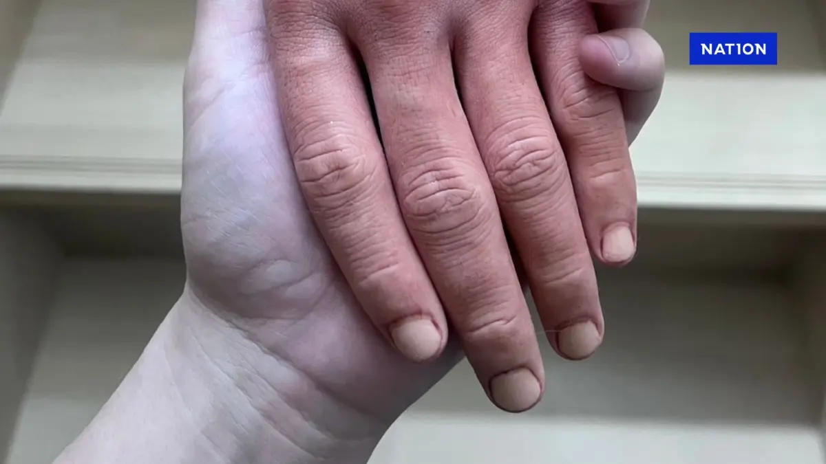 "มือซ้าย" งานศิลปะของนักศึกษาชาวญี่ปุ่น ที่เหมือนจริงจนขนลุก "มือซ้าย" งานศิลปะของนักศึกษาชาวญี่ปุ่น ที่เหมือนจริงจนขนลุก