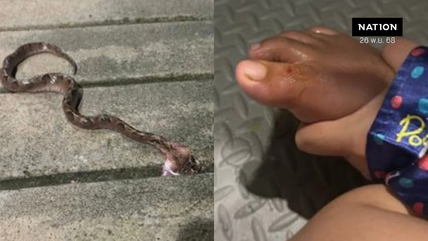 ถึงมือหมอแล้ว! สาวถูกงูกะปะกัด ได้ "เซรุ่ม"แล้ว - รอผลเจาะเลือดทุก 4-6 ชม.