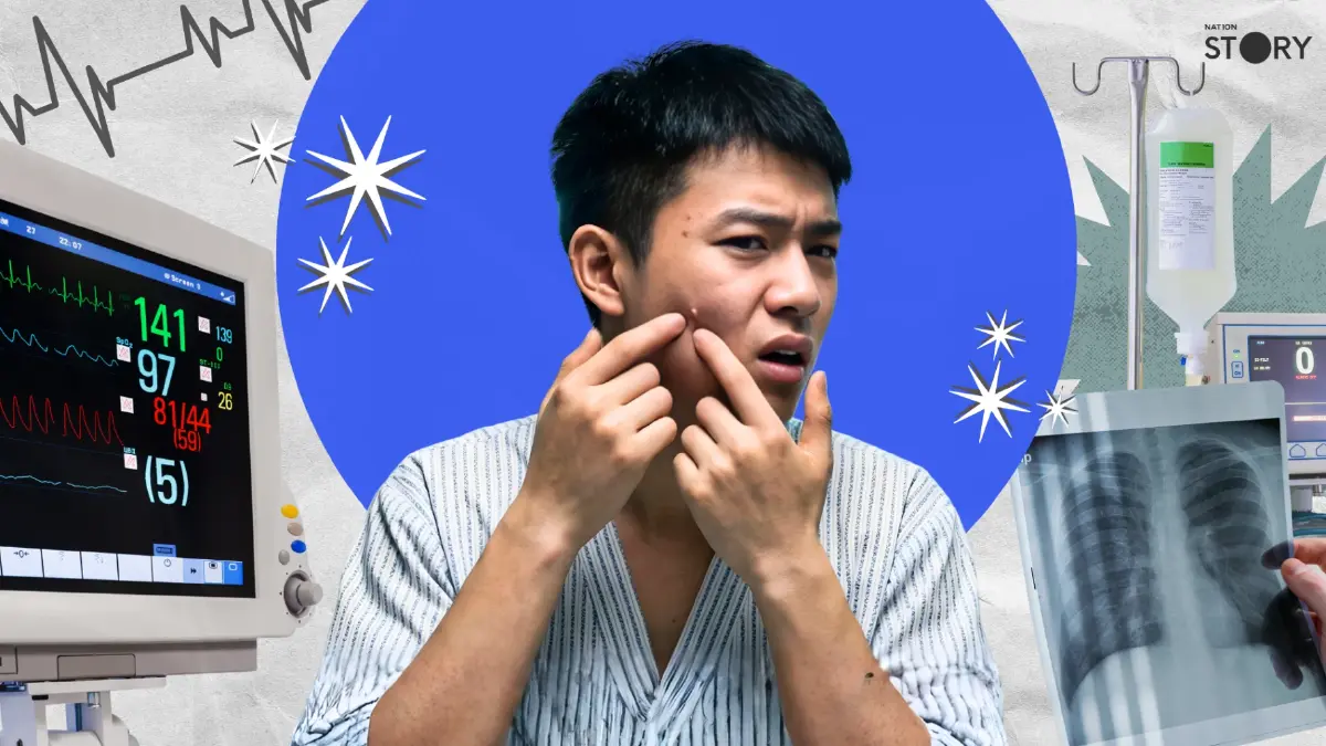 หนุ่มจีนเข้า ICU "บีบสิว" ผิดวิธี ติดเชื้อเกือบถึงชีวิต หนุ่มจีนเข้า ICU "บีบสิว" ผิดวิธี ติดเชื้อเกือบถึงชีวิต