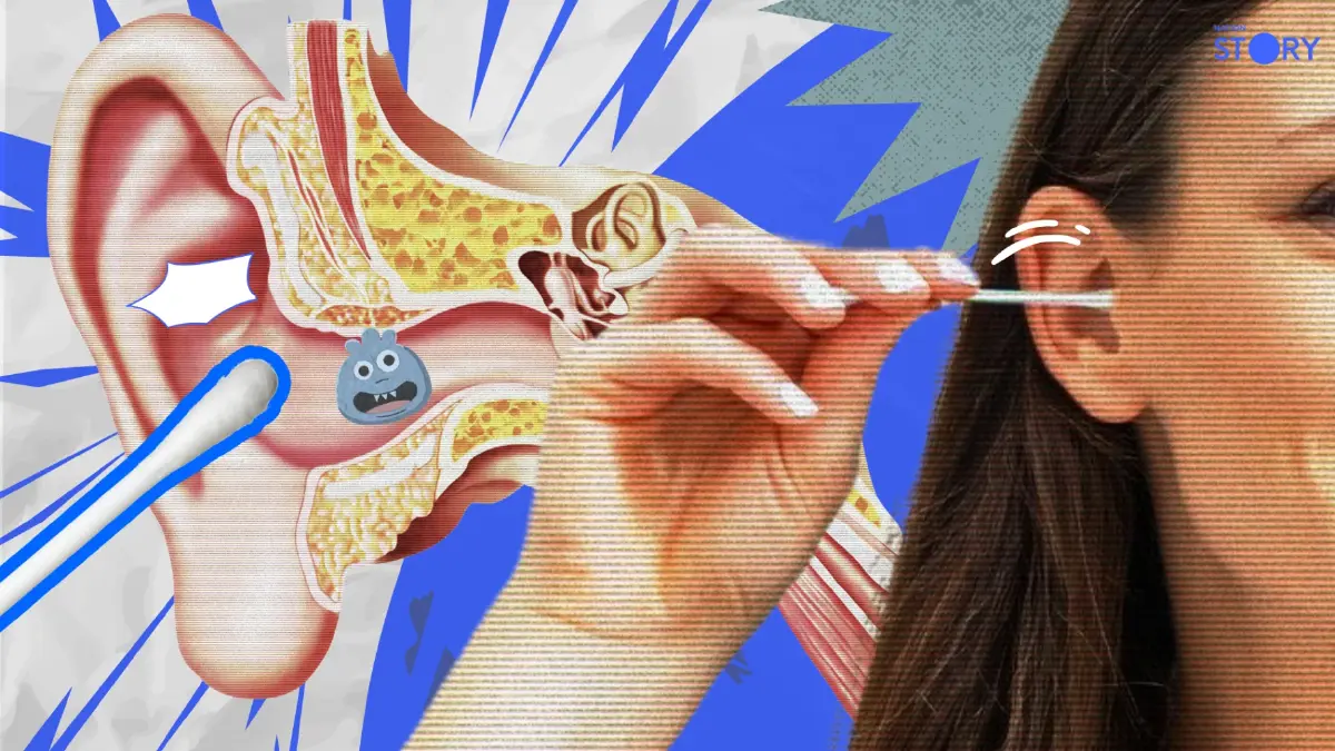 OPINION : ขี้หูไม่ใช่สิ่งสกปรก! หมอแนะ "เลิกแคะ" ได้แล้ว!? OPINION : ขี้หูไม่ใช่สิ่งสกปรก! หมอแนะ "เลิกแคะ" ได้แล้ว!?