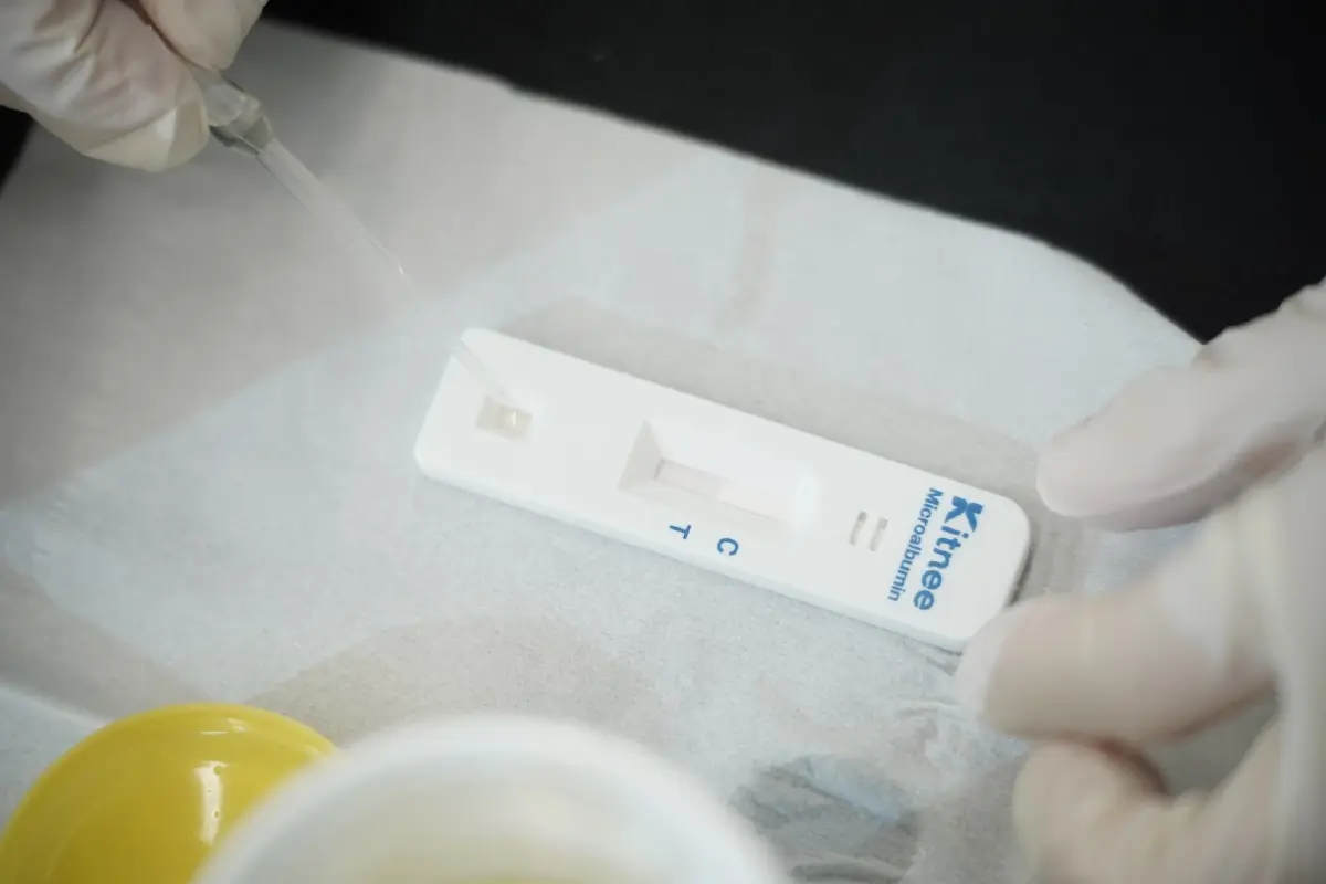 คนไทยกว่า 10 ล้านคนเสี่ยงโรคไต สมาคมโรคไตฯ แนะคัดกรองไวช่วยได้