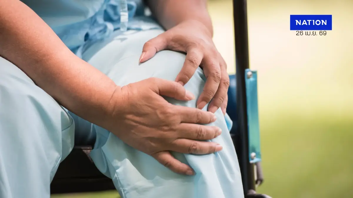 ทางเลือกใหม่รักษาข้อเข่าเสื่อม "GAE" ตัดวงจรปวดแบบไม่ต้องผ่าตัด