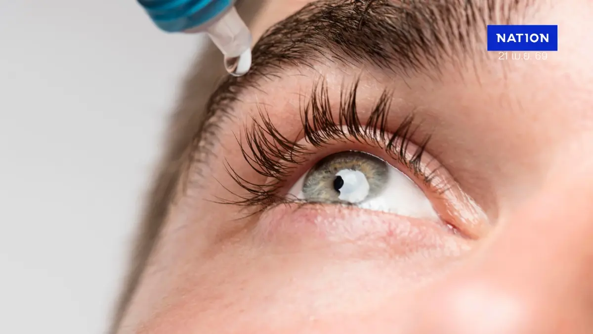 รู้ทัน "สารเคมีเข้าตา" อุบัติเหตุใกล้ตัวที่อาจพรากการมองเห็นถาวร