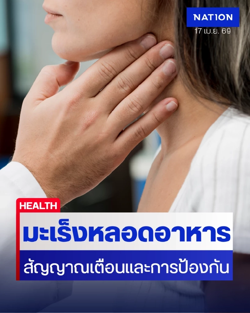 เจาะลึก ‘มะเร็งหลอดอาหาร’ ภัยเงียบที่มากับพฤติกรรม เช็กสัญญาณเตือนก่อนลุกลามเกินเยียวยา