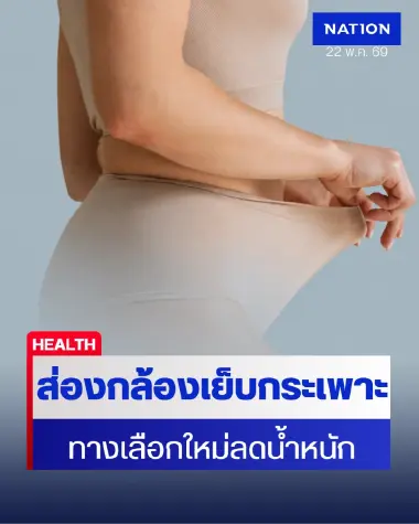 แพทย์เผยเทรนด์ใหม่ "ส่องกล้องเย็บกระเพาะ" ไร้แผลผ่าตัด ทางออกคนดื้อยา-กลัวโยโย่