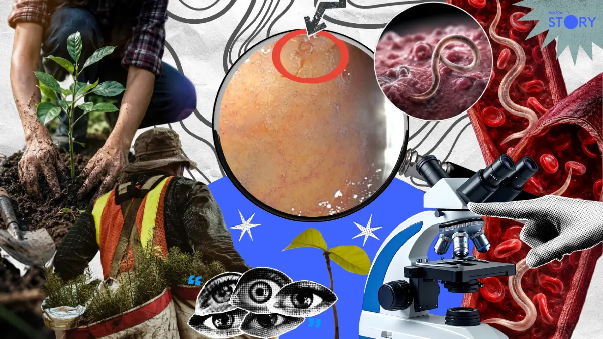 OPINION : ช็อก! ปลูกต้นไม้-เล่นดิน เสี่ยง “พยาธิ” ไชเข้ากระแสเลือด?
