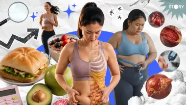 OPINION : รู้จัก TOFI ดูผอม แต่อ้วนแฝง! อายุสั้นลง 7 ปี เสี่ยงโรคเพิ่มเพียบ?